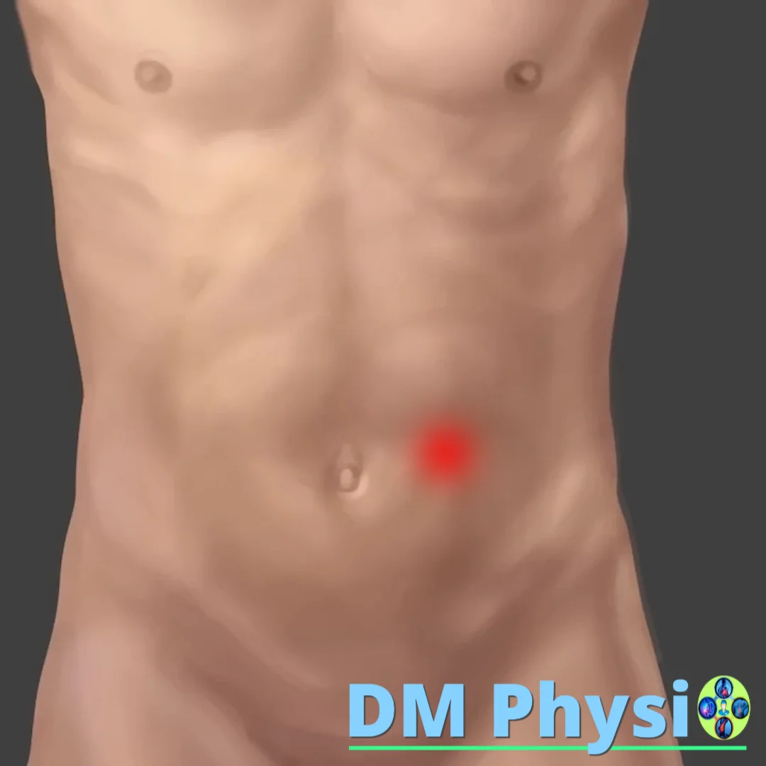 Абдоминална херния - визуализация